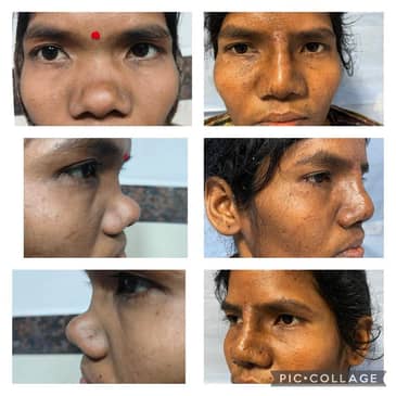 Slider image (2) Konarc Aesthetics - Plastic & Cosmetic Surgery In Gurgaon, India.